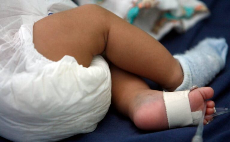 Muere bebe por sarampión en Guerrero; suman 31 decesos en México